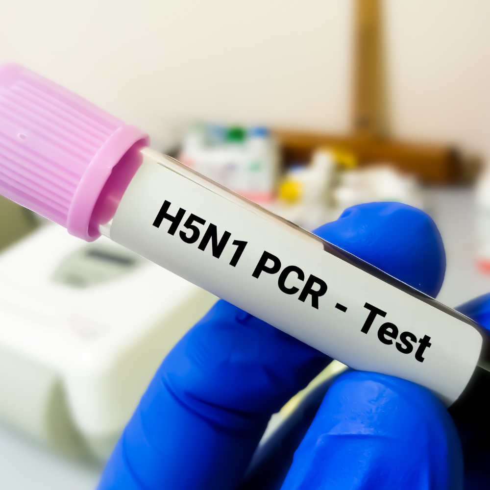 Patient receiving early treatment for H5N1 (avian flu) at a Mediway Health Group clinic.